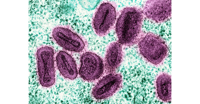Mathematical Model Shows 97.8% Reduction in Simulated Mpox Infections Under a Four-Intervention Strategy